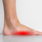 Flat Feet