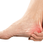 Heel Pain